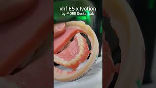 혁신적인 디지털덴쳐틀니 제작 과정 vhf E5 x Ivotion Denture by 박상권 소장 모아치과기공소 [upl. by Anircam78]