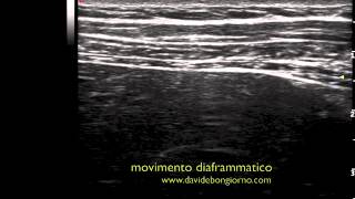 movimento diaframmatico  DIAFRAGMATIC MOVEMENT FUSAE APPROACH [upl. by Marih]