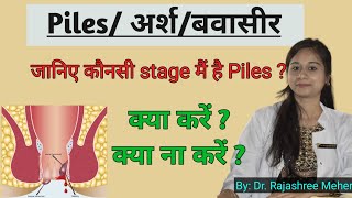 piles stages  piles me kya khana chahiye  piles stages and treatment [upl. by Garceau]