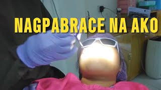 NAGPALAGAY AKO NG BRACES SUPRISING Aksel at nabundol pa ako ng tricykle [upl. by Audie]