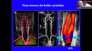 Ultrasound Week School  ECOSU101 lezione 19 [upl. by Aninay]