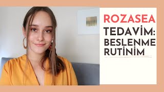 ROZASEA TEDAVİM NASIL BESLENDİM  ROZASEADOSYASI 2 [upl. by Bahr]