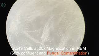 Animal Tissue Culture A549 with Bacterial Contamination and Fungal Contamination [upl. by Ninazan]