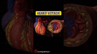 Heart attack short animation  Heart attack cause  cardiology shorts [upl. by Bovill]