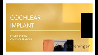 Cochlear Implant  En ærlig film om CIoperation [upl. by Aihsyn933]