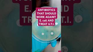 The antibiotics are AMIKACINAK MEROPENEMMEM CIPROFLOXACINCIP TAZOBACTAMTZP AND GENTAMICINCN [upl. by Yasmine]