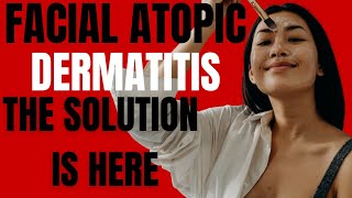 Atopic Dermatitis  Dermatitis Treatment  Atopic Dermatitis Treatments  Discover The Solution Now [upl. by Abigail]