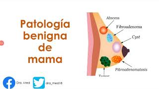 PATOLOGIA BENIGNA DE MAMA FIBROADENOMA MASTOPATÍA FIBROQUÍSTICA REPASO ENARM 🤓 [upl. by Elberta]