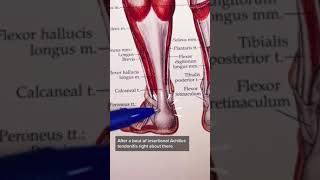 Insertional Achilles Tendonitis [upl. by Richardo185]