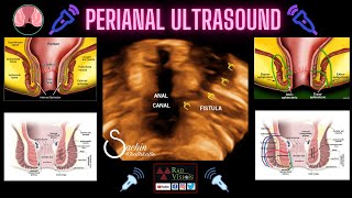 PERIANAL ULTRASOUND [upl. by Onnem188]