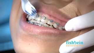 Orthodontic Home Care Instructions  Braces  Brushing [upl. by Dewhirst104]