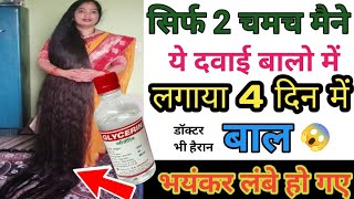 सिर्फ 2 चमच मैं ये दवाई बालो में लगाया 4 दिन में बाल इतने लंबे हो गए  faster hair growth medicine [upl. by Iggie]