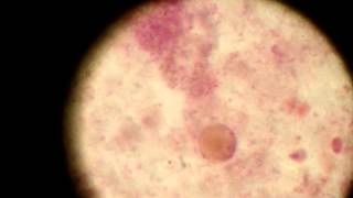 Blastocystis hominis Trophozoite [upl. by Anauq]