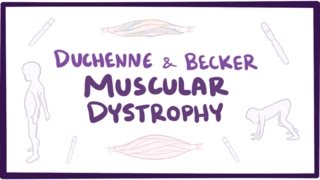 Duchenne amp Becker muscular dystrophy  causes symptoms treatment amp pathology [upl. by Shorter]