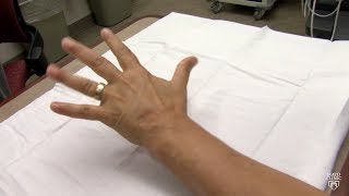 Mayo Clinic Minute What may be causing your hands and feet to tingle [upl. by Ahsemit181]