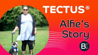 Tectus ® Case Study Alfie Wright Paralympic ParaPowerlifter [upl. by Mychal]