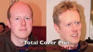 Hair Replacement by Total Cover Plus UK  3 Steps To A Full Head of Hair [upl. by Asamot]