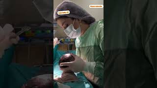 CSECTION delivery duty viralvideo hospital youtube viralvideo duty docters mdmedical00 [upl. by Ellivro]