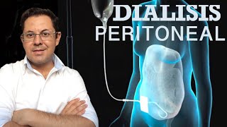 DIALISIS PERITONEAL [upl. by Ellatsyrc]