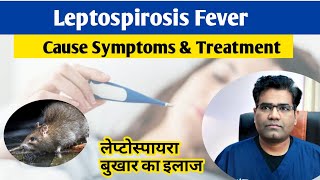 Leptospira Infection Cause Symptoms and Treatment in hindi  Leptospirosis  Fever [upl. by Eibrad]