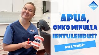 Mikä on ientulehdus [upl. by Edny590]