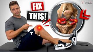 Fix Meniscus Tear Without Surgery Knee Pain Relief Exercises [upl. by Einram544]