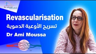 Chirurgie Vasculaire  Revascularisation avec le Dr Ami Moussa  تسريح الأوعية الدموية [upl. by Lyford]