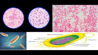 Coloration de Gram avec une observation microscopique [upl. by Luthanen]