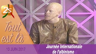 JOURNÉE DE LALBINISME LES PROBLÈMES RENCONTRÉS PAR LES ALBINOS AU SÉNÉGAL  TOUT EST LÀ DU 13 JUIN [upl. by Ynos930]