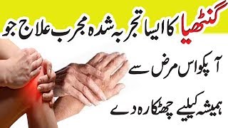 Arthritis Treatment At Home In Urdu  Anam Home Remedy [upl. by Nosnaj697]