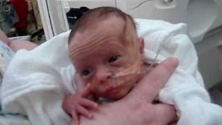 Lillians first bottle feeding and she hit 3 lbs NICU Premature baby [upl. by Aerdnod]