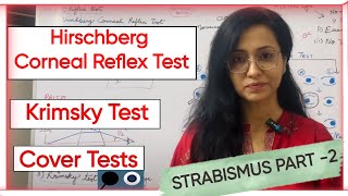 Strabismus Part 2  Hirschberg Corneal Reflex Test  Krimsky Test  Cover Tests [upl. by Annawad]