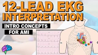 Introductory Concepts for Acute Myocardial Infarction AMI on 12Lead EKG [upl. by Alemaj]