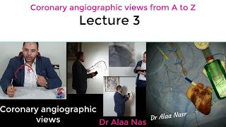 Coronary angiographic views 03 Dr Alaa Nasr Egypt 2020 [upl. by Oicaro205]