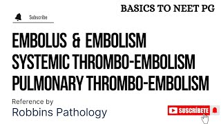 Embolus  Embolism  Part 1  Pulmonary ThromboEmbolism  Systemic ThromboEmbolism  KTC MBBS [upl. by Annnora]