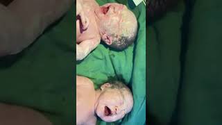 Newborn twins crying very loudly Very cute [upl. by Ebag]