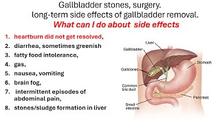 Gallbladder stones surgery Side effects of gallbladder removal What can I do about side effects [upl. by Ecinev]