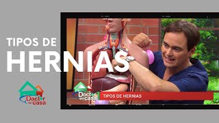 Tipos de hernias [upl. by Childs374]