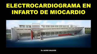 ELECTROCARDIOGRAMA EN INFARTO DE MIOCARDIO II [upl. by Assyli508]