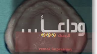 primary impression for edentulous patient [upl. by Feola177]