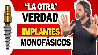 🤔 IMPLANTES DENTALES ESTRATÉGICOS  ¿Son TAN BUENOS los quotNUEVOSquot IMPLANTES MONOFÁSICO sin cirugía [upl. by Derby]