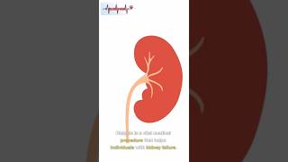 dialysis procedure video  dialysis medical foryou shorts [upl. by Valentin]