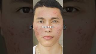 Zuniga on Natural Face Mask Glow Up in 7 Days [upl. by Saberhagen762]