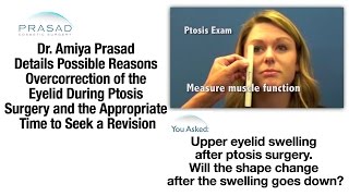 How Swelling after Ptosis Surgery Can Raise the Eyelid and the Right Time for Enhancement [upl. by Samara754]