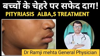 White Patch on Face  Is This Vitiligo or Pityriasis Alba बच्चों के चेहरे पर सफेद दागDr Ramji [upl. by Ttelrats]