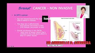 DUCTAL CARCINOMA IN SITU [upl. by Feld]