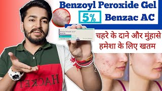 Benzac AC 5 Gel Review  Benzoyl Peroxide 5 Gel Benifits [upl. by Mary525]