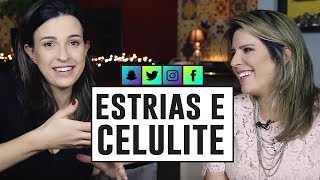 DICAS para TRATAR E PREVENIR de ESTRIAS e CELULITE com Dra Cintia Cunha [upl. by Etti]