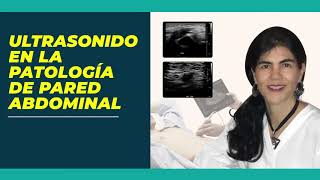 Ultrasonido en la patología de pared abdominal [upl. by Philipa]