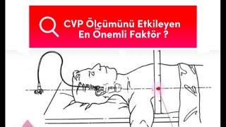 CVP ölçümü Santral venöz basıncı etkileyen en önemli faktör yoğunbakım hemşire sağlıkçı keşfet [upl. by Akimet]